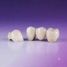 Dental crown and bridge