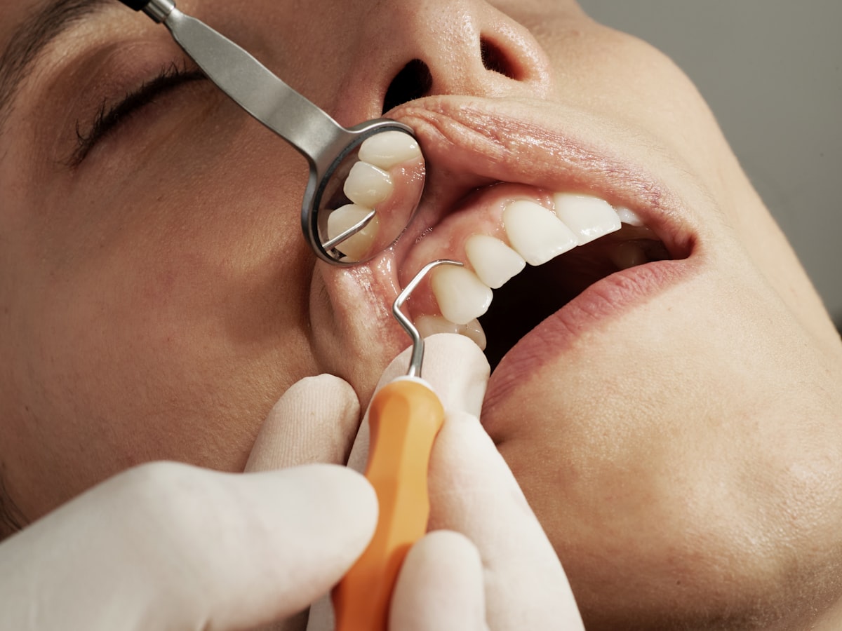Dental implant placement at Modern Dental Concepts in Warren, OH